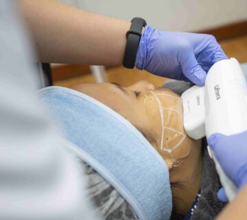 Mneghilangkan double chin secara alami dengan Liftera HIFU Treatment di MurniCare Skin Clinic Jakarta