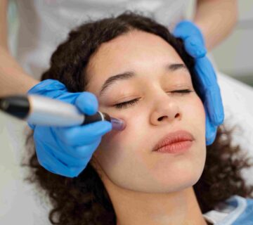 dermapen jakarta. microneedling jakarta. perawatan bekas jerawat. treatment microneedling. bekas jerawat membandel. pori-pori besar. kolagen kulit. klinik kecantikan jakarta barat. perawatan kulit minim invasif. dermapen adalah. microneedling adalah. MurniCare Skin Clinic Jakarta. murnicare glam studio jakarta.