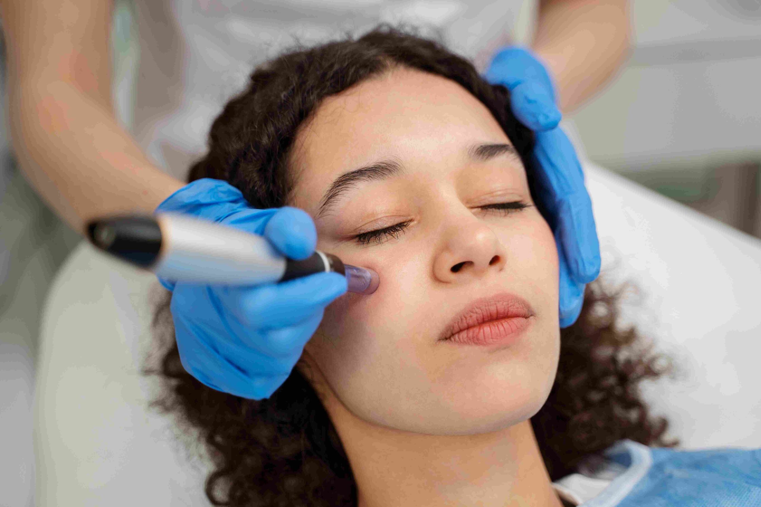 dermapen jakarta. microneedling jakarta. perawatan bekas jerawat. treatment microneedling. bekas jerawat membandel. pori-pori besar. kolagen kulit. klinik kecantikan jakarta barat. perawatan kulit minim invasif. dermapen adalah. microneedling adalah. MurniCare Skin Clinic Jakarta. murnicare glam studio jakarta.