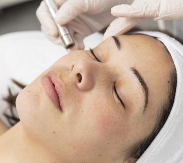 Microdermabrasi