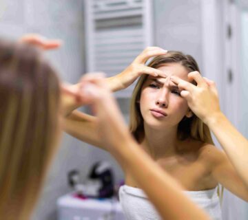 Ilustrasi Wajah Berjerawat