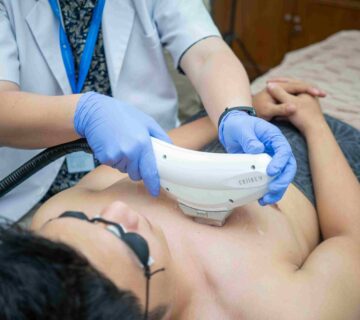 Ilustrasi : IPL Hair Removal di MurniCare Skin Clinic Jakarta
