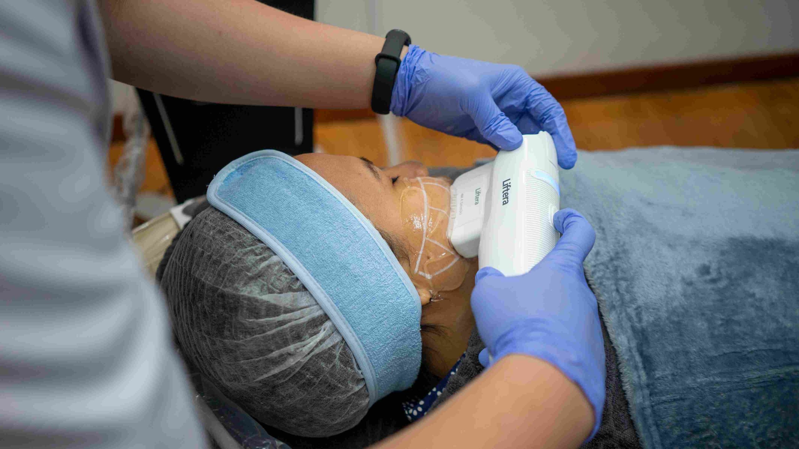 Berapa lama hasil HIFU terlihat? Cara kerja HIFU treatment | murnicare skin clinic jakarta